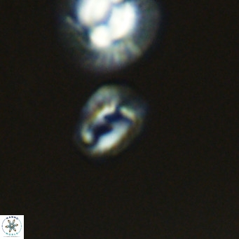 Helicosphaerella philippinensis VR 09275