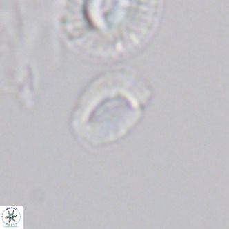 Helicosphaerella philippinensis VR 09277