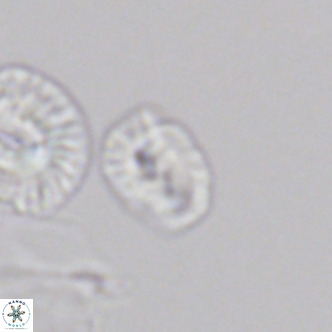 Helicosphaerella philippinensis VR 09279