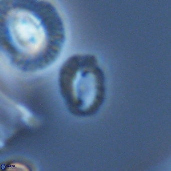 Helicosphaerella philippinensis VR 09284