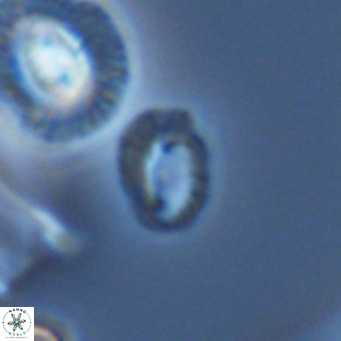 Helicosphaerella philippinensis VR 09284