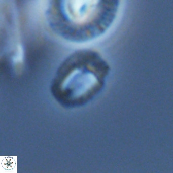 Helicosphaerella philippinensis VR 09286