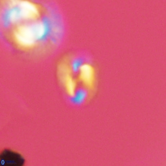 Helicosphaerella philippinensis VR 09289