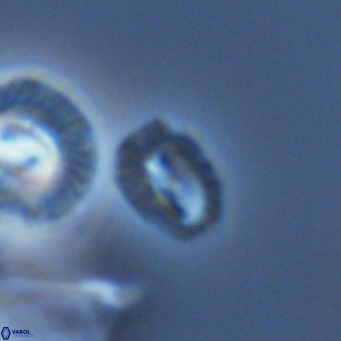 Helicosphaerella philippinensis VR 09282