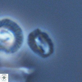 Helicosphaerella philippinensis VR 09282