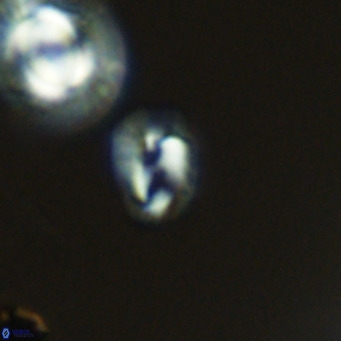 Helicosphaerella philippinensis VR 09290