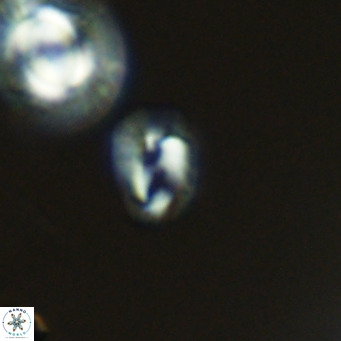 Helicosphaerella philippinensis VR 09290