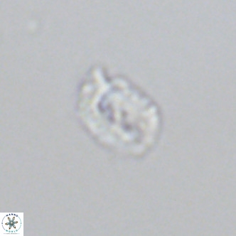 Helicosphaerella philippinensis VR 09416