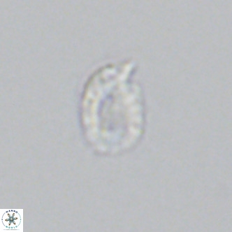 Helicosphaerella philippinensis VR 09418
