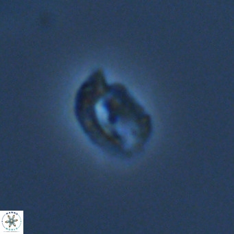 Helicosphaerella philippinensis VR 09424