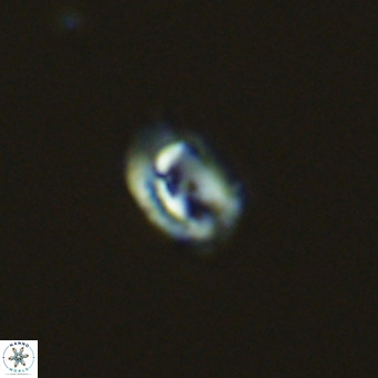 Helicosphaerella philippinensis VR 09427