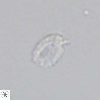 Helicosphaerella philippinensis VR 09421