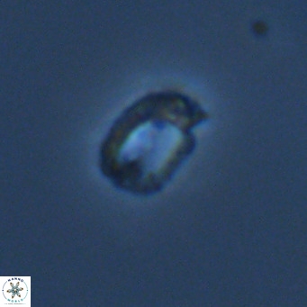 Helicosphaerella philippinensis VR 09422