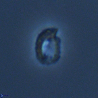 Helicosphaerella philippinensis VR 09423