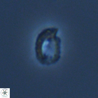 Helicosphaerella philippinensis VR 09423