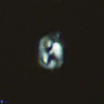 Helicosphaerella philippinensis VR 09430