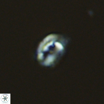 Helicosphaerella philippinensis VR 09431