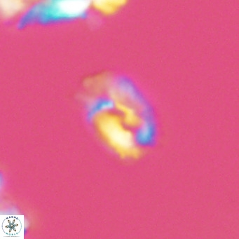 Helicosphaerella philippinensis VR 09528