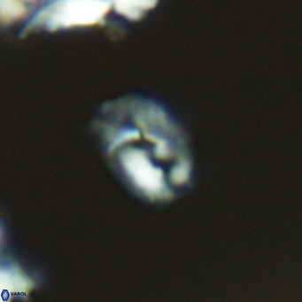 Helicosphaerella philippinensis VR 09529