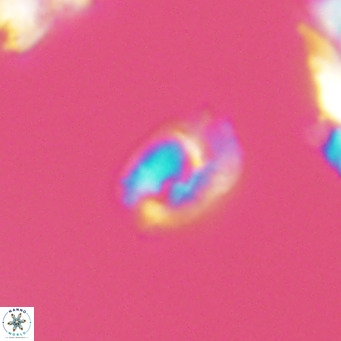 Helicosphaerella philippinensis VR 09523