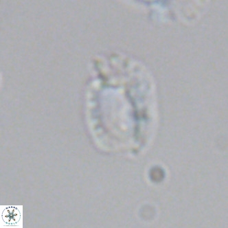 Helicosphaerella philippinensis VR 09534