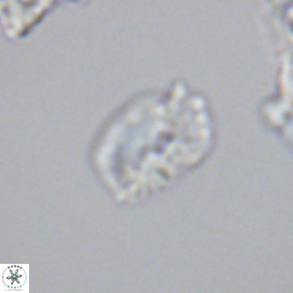 Helicosphaerella philippinensis VR 09537