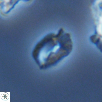 Helicosphaerella philippinensis VR 09538