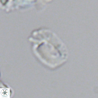 Helicosphaerella philippinensis VR 09531