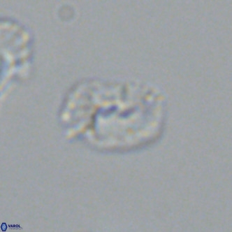 Helicosphaerella philippinensis VR 09546