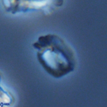 Helicosphaerella philippinensis VR 09541