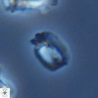 Helicosphaerella philippinensis VR 09541