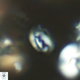 Helicosphaerella philippinensis VR 09695