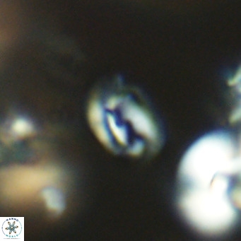 Helicosphaerella philippinensis VR 09698
