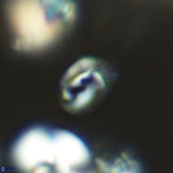 Helicosphaerella philippinensis VR 09699