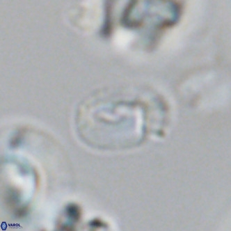 Helicosphaerella philippinensis VR 09704