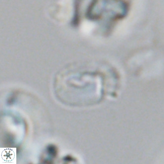 Helicosphaerella philippinensis VR 09704