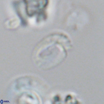 Helicosphaerella philippinensis VR 09705