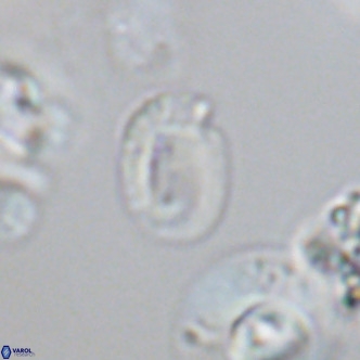 Helicosphaerella philippinensis VR 09706