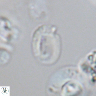 Helicosphaerella philippinensis VR 09706
