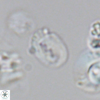 Helicosphaerella philippinensis VR 09708