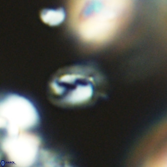 Helicosphaerella philippinensis VR 09701