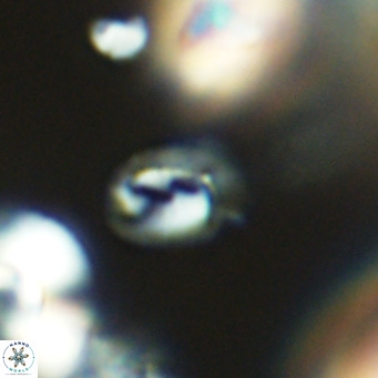 Helicosphaerella philippinensis VR 09701