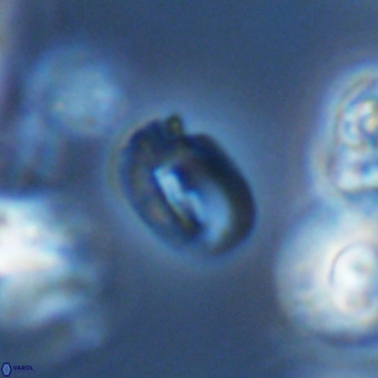 Helicosphaerella philippinensis VR 09710