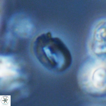 Helicosphaerella philippinensis VR 09710