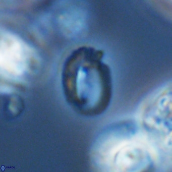 Helicosphaerella philippinensis VR 09711