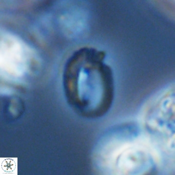 Helicosphaerella philippinensis VR 09711