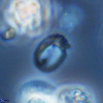 Helicosphaerella philippinensis VR 09712