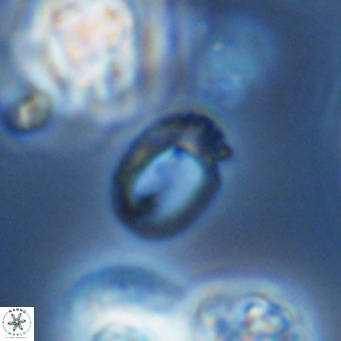 Helicosphaerella philippinensis VR 09712