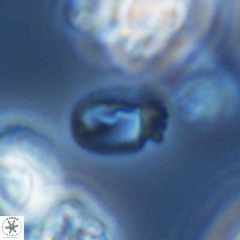 Helicosphaerella philippinensis VR 09713