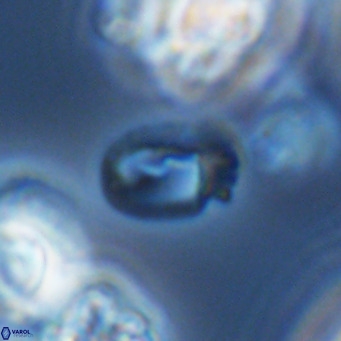 Helicosphaerella philippinensis VR 09713